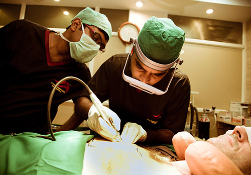 Best Hair Transplant Surgeon in Bangalore