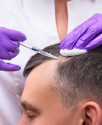 Best hair transplant clinic in bangalore
