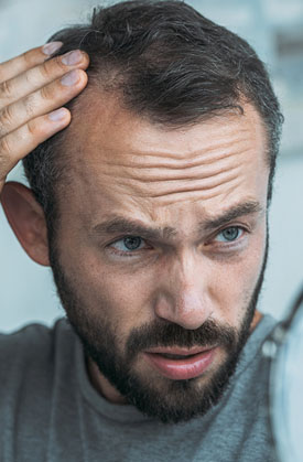 Best Hair Transplant in Bangalore