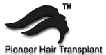 Hair Transplants Bangalore